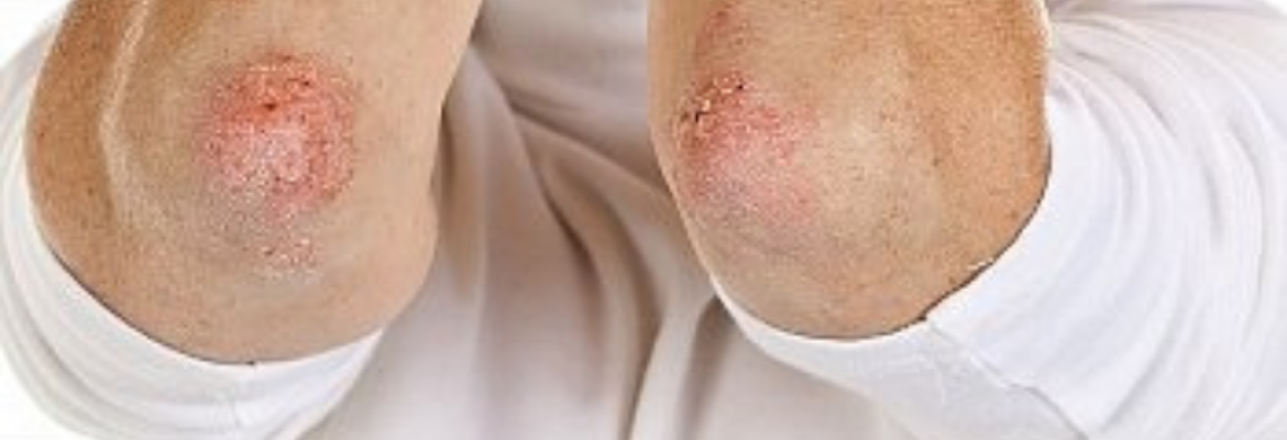 Pure Herbal Ayurved Clinic